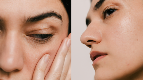 BUILD YOUR OWN SKINCARE, BECAUSE YOUR SENSITIVE SKIN MATTERS